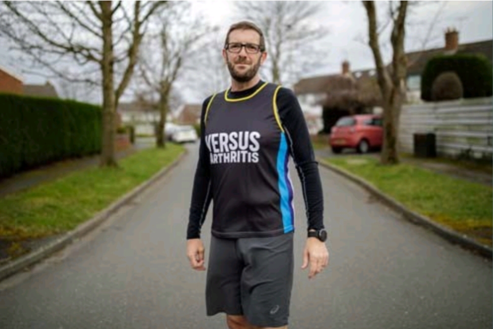 Ian psoriasis story