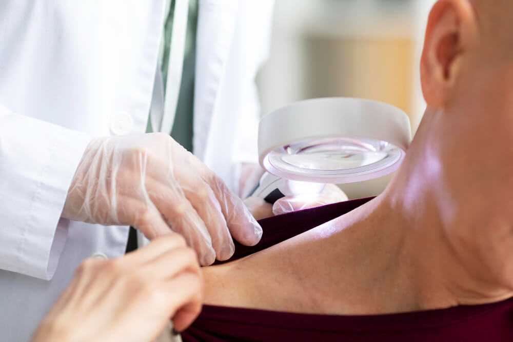 dermatologist examining skin under a dermatoscope